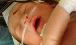 Bé văng khỏi bụng mẹ nhận được 2 tỷ đồng quyên góp