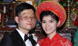 Cặp đôi chuyện tình không tưởng chấn động mạng giờ ra sao? 