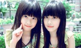 7 cặp chị em song sinh nổi tiếng vì vẻ đẹp thiên thần