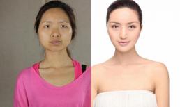 Những cô gái trẻ 'đổi đời' nhờ phẫu thuật thẩm mỹ