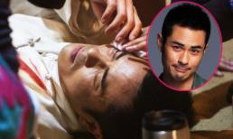 Trịnh Gia Dĩnh nguy cơ mất sự nghiệp vì hỏng một mắt