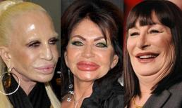 Sao nữ tự 'tàn phá' dung nhan vì lạm dụng 'dao kéo'