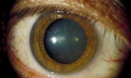 Những nguy hại kinh hoàng không ngờ của tác hại từ thuốc lá