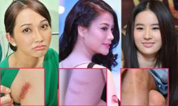 Những 'vết tích' khó hiểu trên cơ thể sao (P6) 