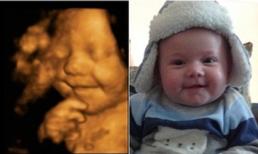 'Cậu bé hạnh phúc nhất nước Anh' biết cười khi còn trong bụng mẹ