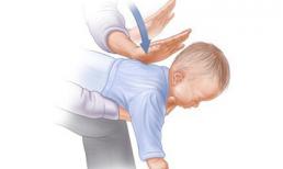 Cẩm nang sơ cứu trẻ bố mẹ CẦN biết