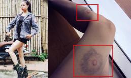 Trà Ngọc Hằng chân tím bầm vì chơi trò chơi