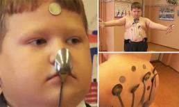 Cậu bé biến thành thỏi nam châm sống sau khi bị điện giật