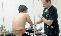 Người đàn ông may mắn sống sót dù bị ống nước sắt xuyên thủng bụng