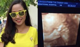 Ốc Thanh Vân khoe ảnh siêu âm đáng yêu của con trai