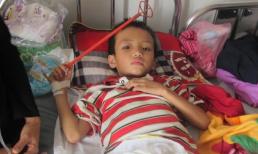 Bé trai 7 tuổi bị bố chất rơm đốt: “Cháu sợ công an bắt bố”