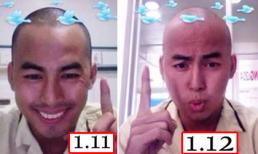 Duy Nhân gầy sọp sau một tháng cách ly điều trị bệnh ung thư