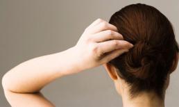 Mái tóc tiết lộ gì về sức khỏe?