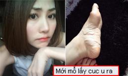 Ngân Khánh nhập viện mổ khối u ở chân