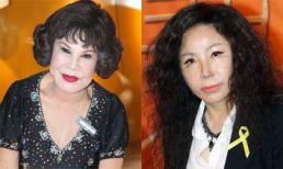 Những ca 'thẩm mỹ hỏng' gây chấn động showbiz châu Á 2014