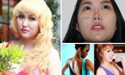 Sau teo mũi, fan sợ Phi Thanh Vân biến dạng toàn thân vì hậu quả dao kéo