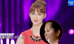 Màn “lột xác” ngoạn mục của cô gái “không có cằm“