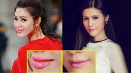 Nghi án Maria Đinh Phương Ánh bơm môi mọng quá đà