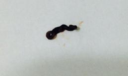 Con vắt dài 3cm chui vào mắt người sống nhiều ngày