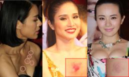 Những "vết tích" khó hiểu trên cơ thể sao (P5) 