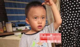 Hơn bốn năm sau vụ trẻ sơ sinh bị đ&#243;ng kim kh&#226;u lốp ngập đầu