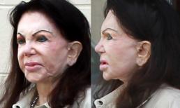 "Hoảng" vì khuôn mặt "chảy nhão" của sao nữ 92 tuổi nghiện thẩm mỹ