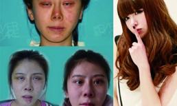 Những người đẹp trở nên xấu thảm hại vì nghiện phẫu thuật thẩm mỹ