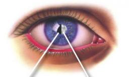 Những bệnh ở mắt có thể dẫn đến mù lòa