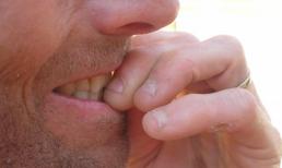 Cầu thủ bóng đá tử vong vì cắn móng tay tới chảy máu