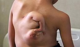 Sôc với hình ảnh cô bé có cánh tay thứ ba "mọc" ở lưng