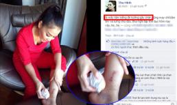 Fan hốt hoảng với ảnh Thu Minh bị kính đè suýt gãy chân