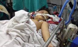 Bắt kẻ dùng điếu cày đánh con chấn thương sọ não