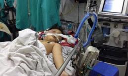 Bố đánh dã man, con 8 tuổi nguy cơ tử vong 99%