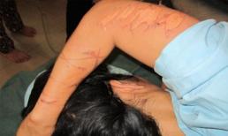 Đồng Nai: Dùng nhục hình, tra tấn phụ nữ như thời trung cổ