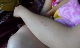 Nạn rạch mông, rạch đùi nữ sinh lan tới Nha Trang