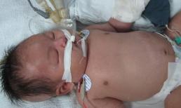 Tiêm phòng lao cho trẻ và những vấn đề mẹ cần biết