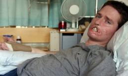 Choáng với những vụ vi khuẩn ăn thịt người