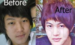 Chàng trai phẫu thuật 50 lần để trở thành mỹ nam