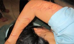 Những vụ dùng "nhục hình" như thời trung cổ