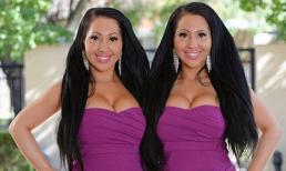 Cặp sinh đôi phẫu thuật giống nhau, chia sẻ bạn trai vì quá gắn bó