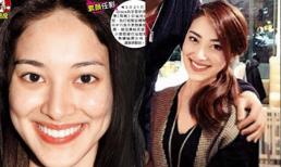 Tân Hoa hậu Hồng Kông bị tố chi hơn 200 triệu để thẩm mỹ