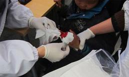 Lên cơn giận bố, mẹ chặt phăng 3 ngón tay con trai 8 tuổi