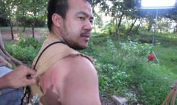 Hiếu Hiền bầm dập vì tự thân đóng cảnh nguy hiểm