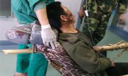 Tài xế may mắn thoát chết dù bị cây đâm xuyên qua người