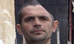 Người đàn ông bị lõm hộp sọ do ngã từ trên cao