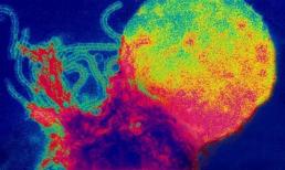 Đã tìm ra thuốc chống bệnh sởi hiệu quả