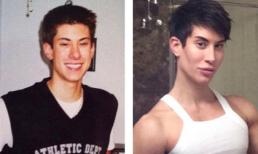 Cuộc sống thực của chàng trai phẫu thuật làm búp bê Ken