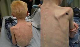 Bỏ đói con trai 5 tuổi còn da bọc xương