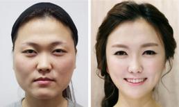 Rắc rối khó lường khi từ "vịt hóa thiên nga"