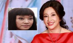 Cơn sốt trẻ hóa không phẫu thuật của các ngôi sao trên thế giới 